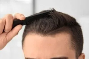 Hair Problems
